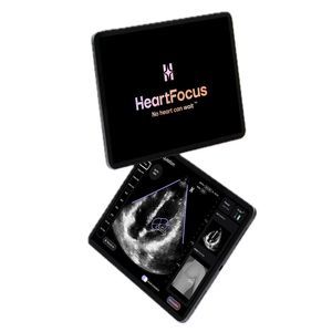 aplicativo móvel para ecocardiografia