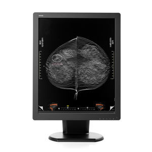 monitor de diagnóstico