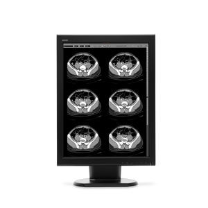 monitor de diagnóstico