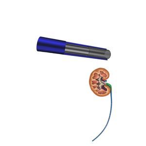 bainha de acesso ureteral