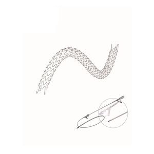 stent uretral