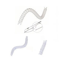 stent ureteral