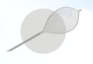 cesta extratora de pólipos intestinais