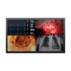 monitor médico-hospitalar