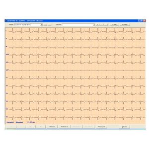 software para eletrocardiografia