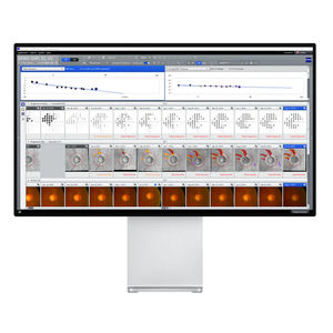 software para oftalmologia