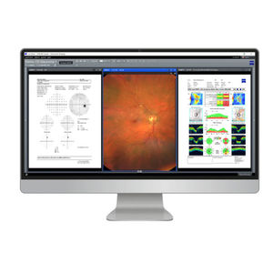 software para cirurgia oftalmológica