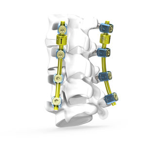 sistema de osteossíntese tóraco-lombo-sacral