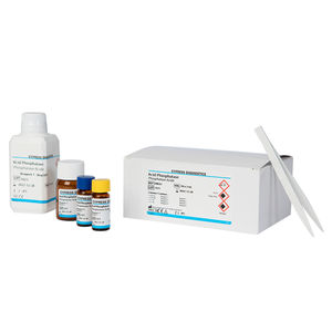kit de reagentes de fosfatase ácida