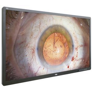 monitor para endoscopia