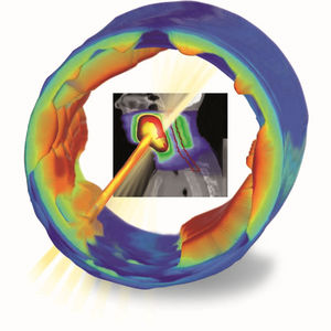 software para radioterapia