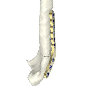 placa para osteotomia veterinária