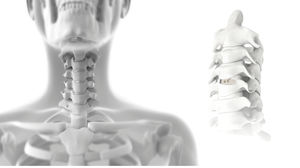 espaçador intervertebral cervical