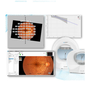 software para oftalmologia