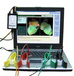 sistema de cartografia cardíaco / ECG