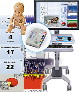 monitor de paciente para EEG