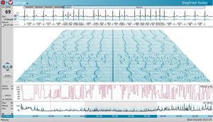 software para holter cardíaco