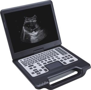 aparelho de ultrassom portátil