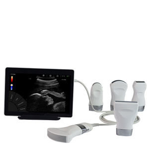 aparelho de ultrassom de bolso