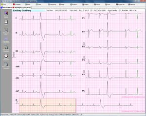 software para eletrocardiografia