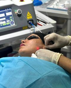 aparelho de rejuvenescimento da pele a laser 1