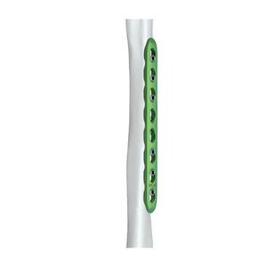 placa de compressão óssea para úmero 1