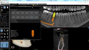 software para cirurgia odontológica