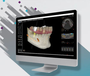 software para cirurgia odontológica