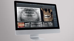 software para imagiologia dentária