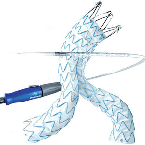 stent-enxerto de aorta abdominal
