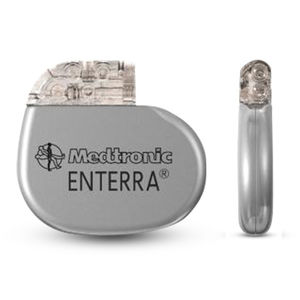neuroestimulador implantável