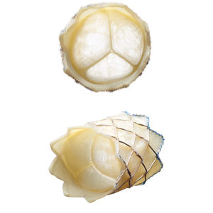 bioprótese valvar pulmonar / de tecido bovino / sem sutura