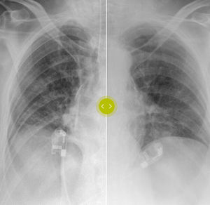 algoritmo para radiologia