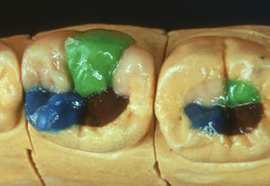 material dentário em cera