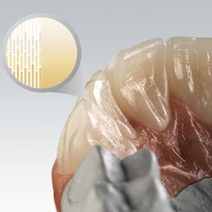 material dentário em zircônia