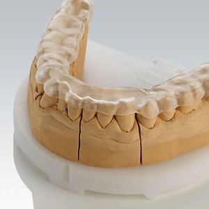 material dentário em PMMA