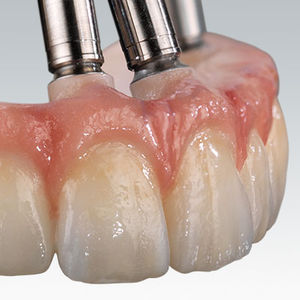 material dentário em zircônia