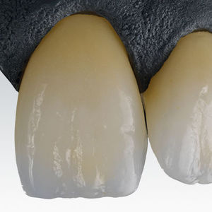 material dentário em zircônia