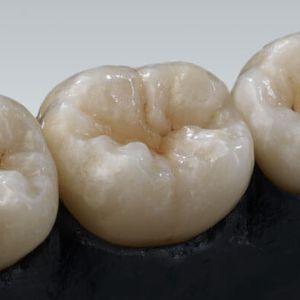 material dentário em zircônia