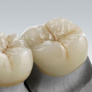 material dentário de vitrocerâmica
