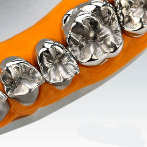 material dentário em cromo-cobalto