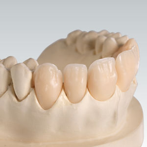 material dentário em acrílico