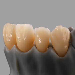material dentário em dióxido de zircônio