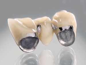 material dentário em cerâmica