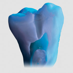 material dentário em cerâmica