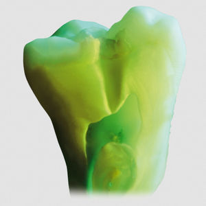 material dentário em cerâmica