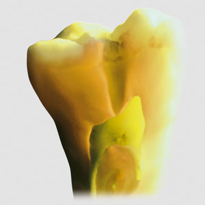 material dentário em cerâmica