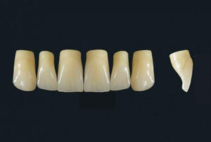 prótese dentária em polímero acrílico 1