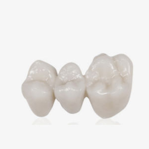 material dentário para restauração dentária