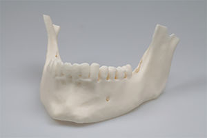 material dentário em resina acrílica
